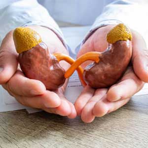 renal transplantation